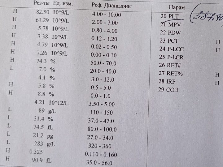 Analyzer printout: leukocytosis 82.5×10⁹/L and hyperthrombocytosis 1631×10⁹/L