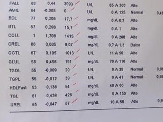 Biochemistry: zero amylase and low creatinine with very high ALP and GGT