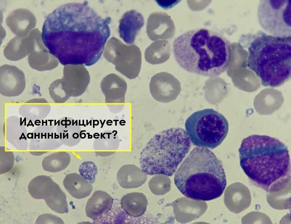 Мазок костного мозга: крупный тромбоцит среди эритроцитов и клеток миелопоэза