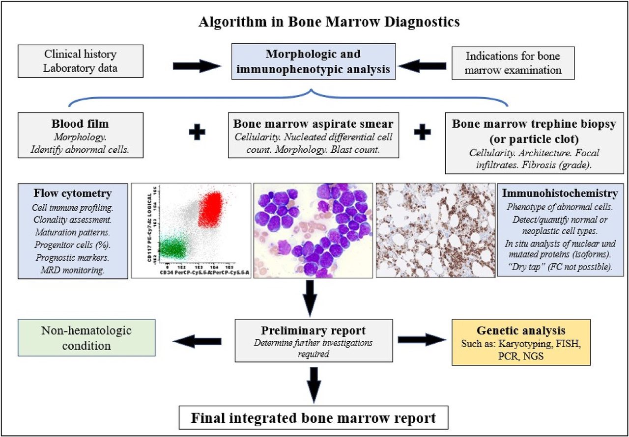Bone Marrow Examination: Modern ICSH Standards