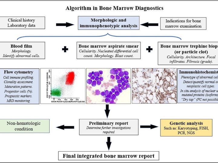 Diagnostic algorithm scheme for comprehensive bone marrow examination