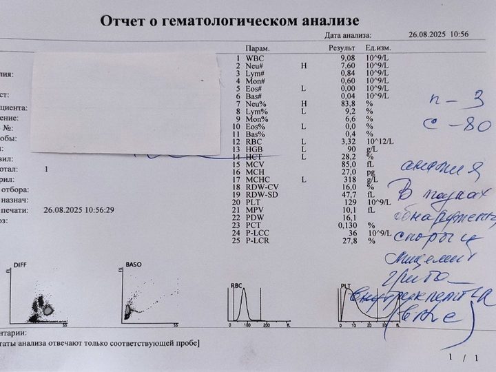 Распечатка анализатора с записью об обнаружении элементов гриба в мазке