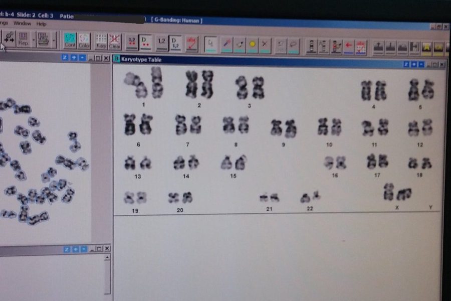 Karyotyping: Cytogenetic Analysis of Chromosomes