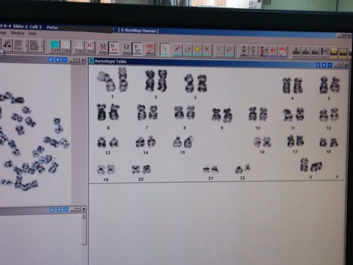 Monitor screen with BandView software, human karyogram 46,XX