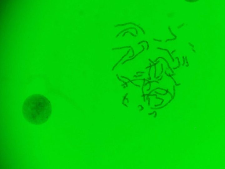 Microphotography of a metaphase plate with chromosomes through a green filter