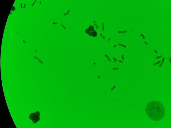 Microphotography of a cytogenetic preparation with chromosome spread