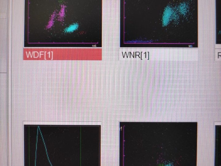 Распечатка анализатора: скаттерограммы каналов WDF, WNR и гистограмма тромбоцитов