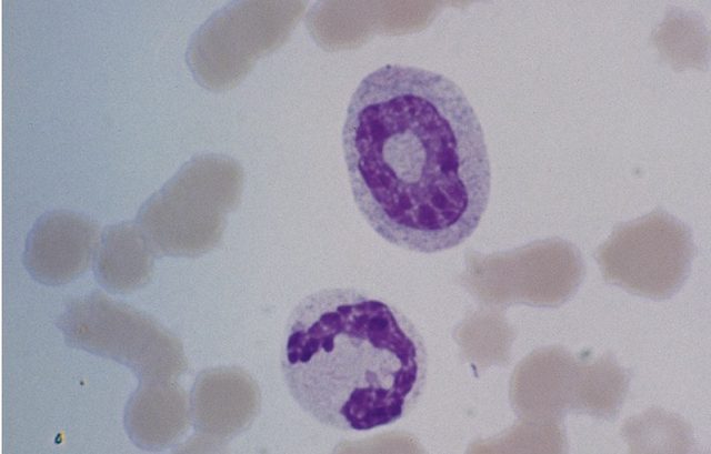 Ring-shaped Neutrophil Nuclei in Equine Blood Smears