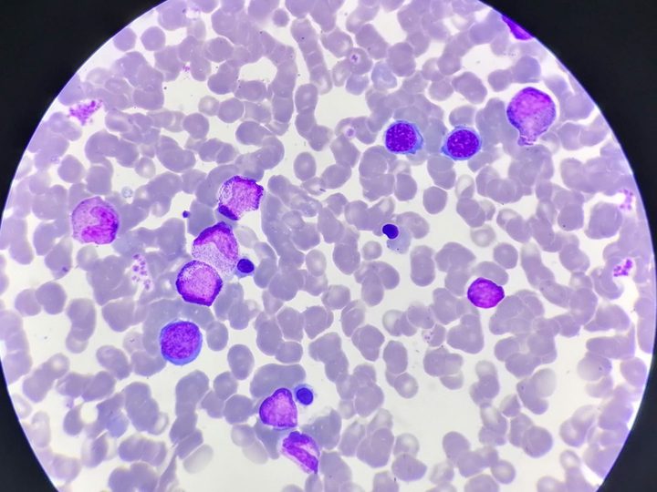 Bone marrow smear: myeloid to erythroid lineage ratio
