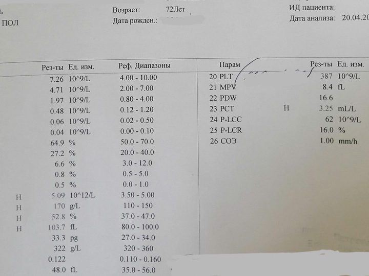 Analyzer printout: erythrocytosis with HGB 170 g/L and hematocrit 52.8%