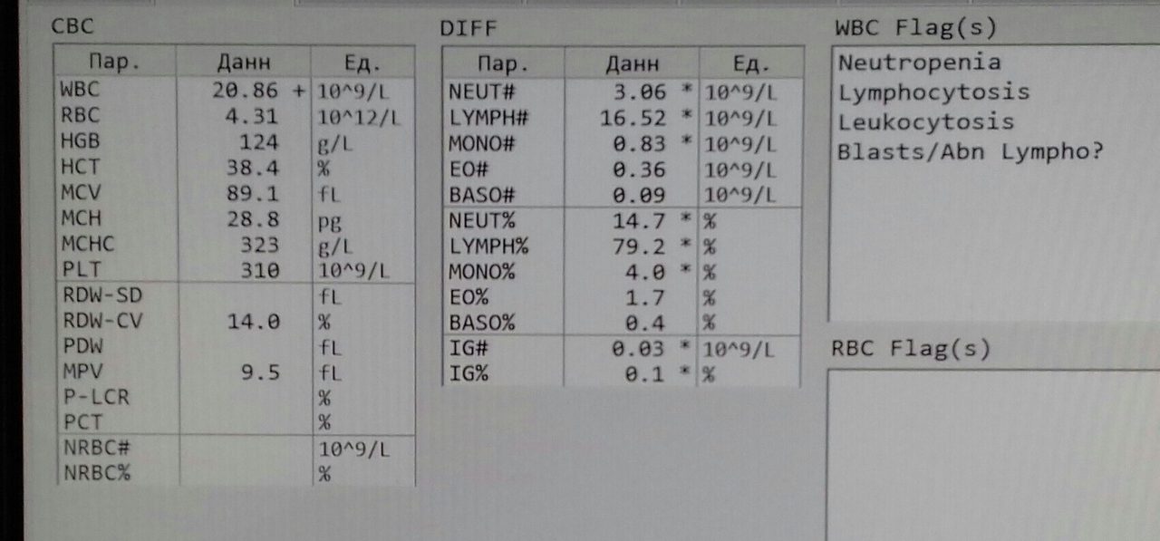 Кристаллические включения в цитоплазме лимфоцитов