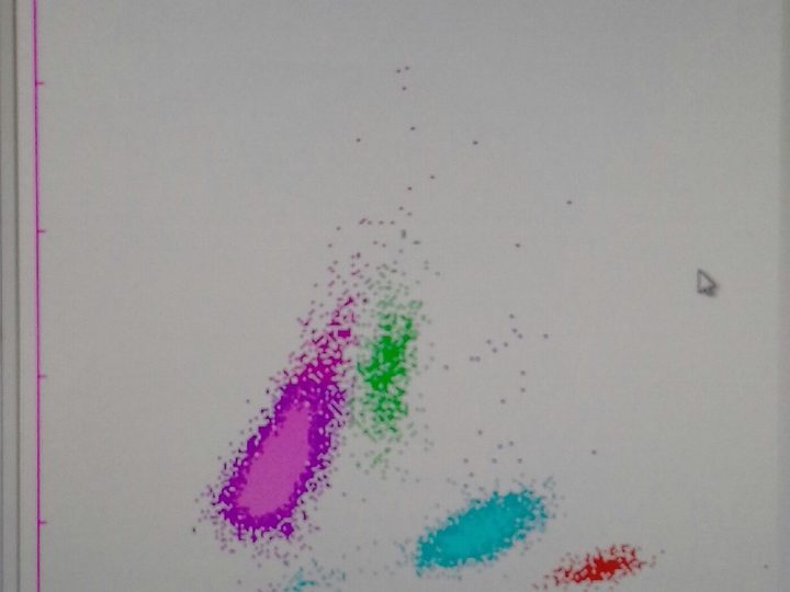 Скаттерграмма WDF анализатора с областью атипичных лимфоцитов