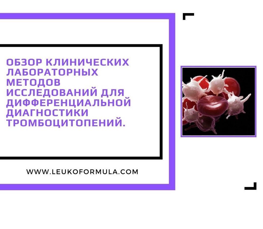 Обзор методов диагностики тромбоцитопений