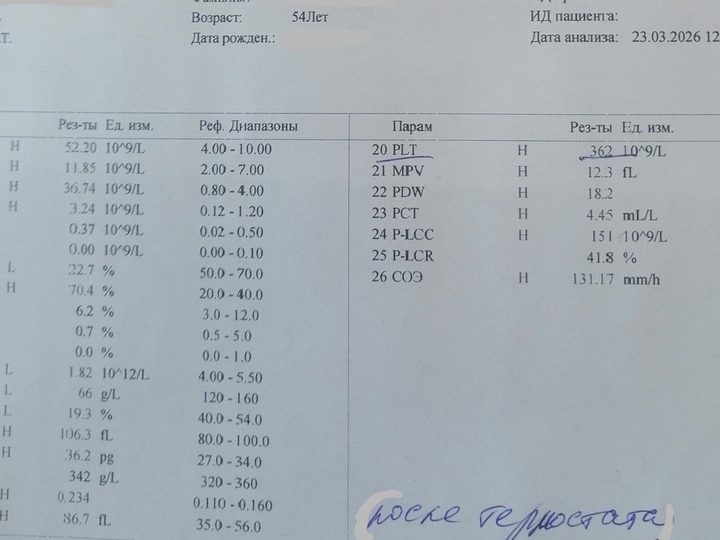 Распечатка анализатора после прогрева: RBC 1,82×10¹²/л и лимфоцитоз 70,4%