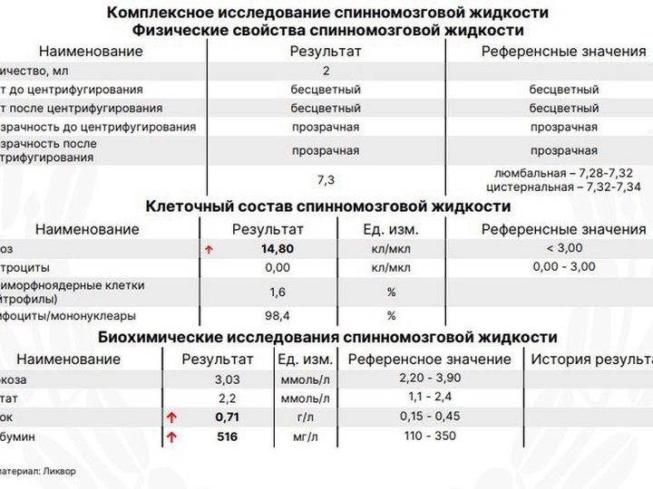 Бланк исследования ликвора: цитоз 14,8 кл/мкл и белок 0,71 г/л