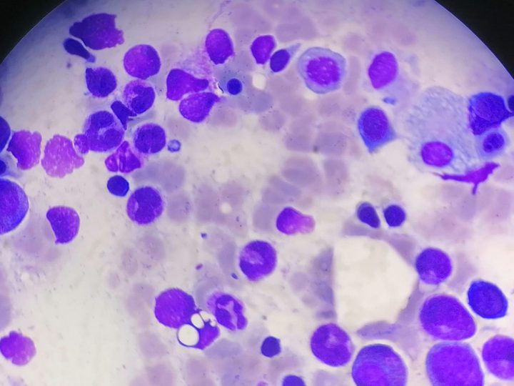 Bone marrow smear, macrophage and differentiating hematopoietic cells