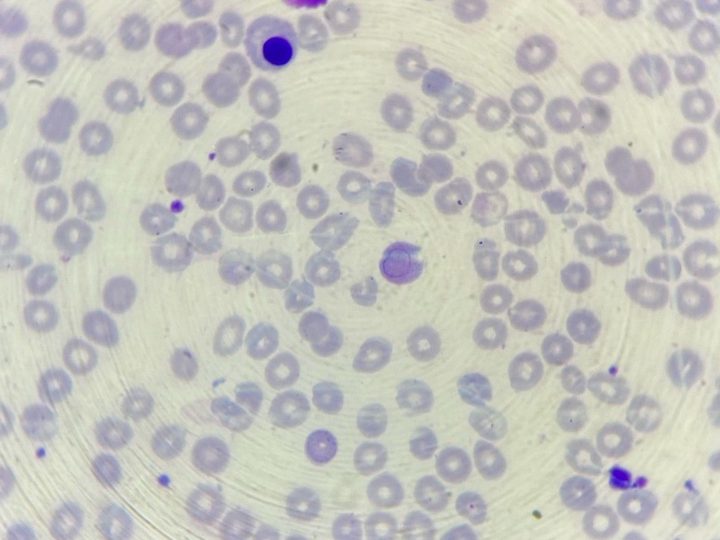 Blood smear: normoblast and erythrocyte with a remnant of the mitotic spindle