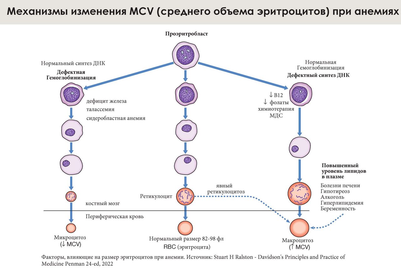 Mechanisms of MCV Changes: Microcytosis and Macrocytosis