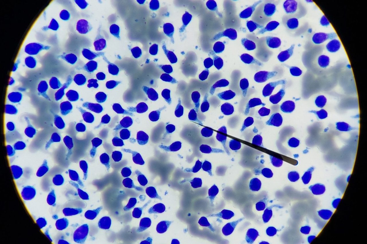 Canine Small Cell Lymphoma: Lymph Node Cytology