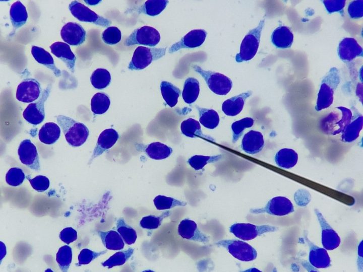 Canine lymph node aspirate smear, higher magnification: morphology of small lymphocytes