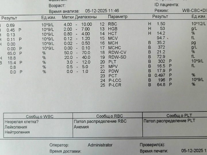 Analyzer printout, severe leukopenia WBC 0.69×10⁹/L and anemia HGB 53 g/L