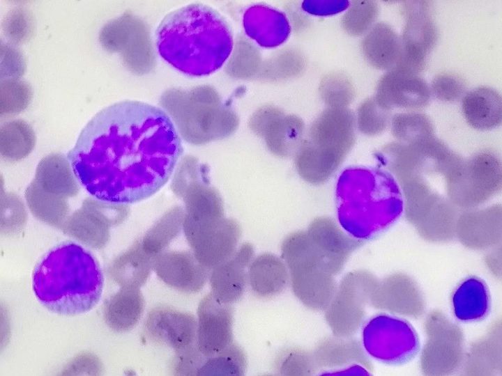 Мазок костного мозга: клетка в стадии митоза, лимфоциты и гранулоциты