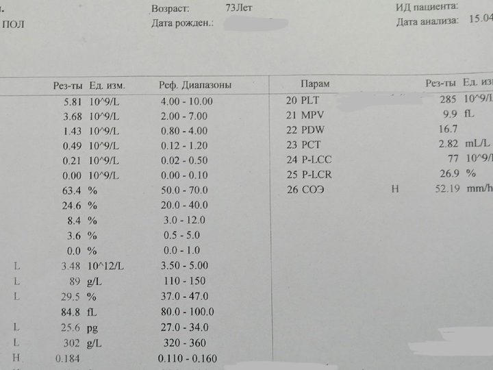 Бланк общего анализа крови: гемоглобин 89 г/л и ускорение СОЭ до 52,19 мм/ч