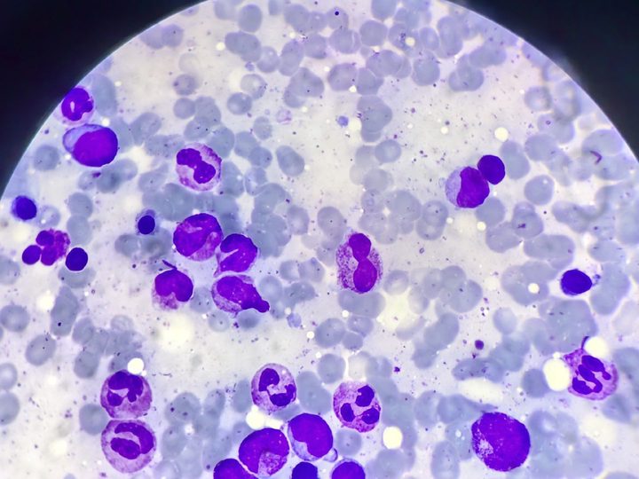 Bone marrow smear: granulocytic lineage cells and erythrocytes