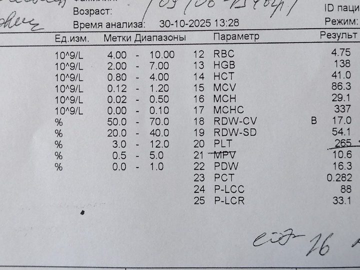 Analyzer printout, marked leukocytosis WBC 66.63 and neutrophilia
