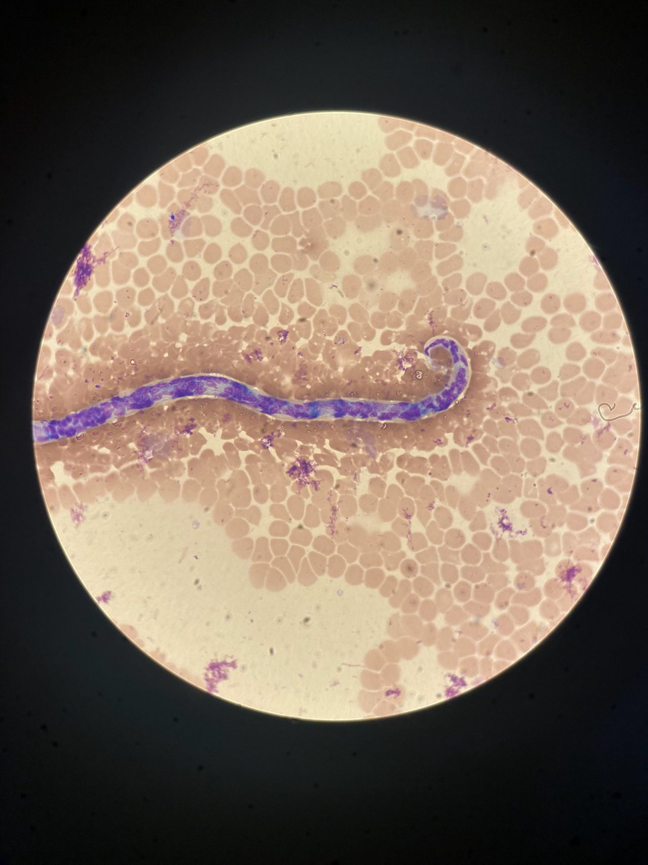 Microfilariae and Babesia in a Dog's Blood Smear: Co-infection