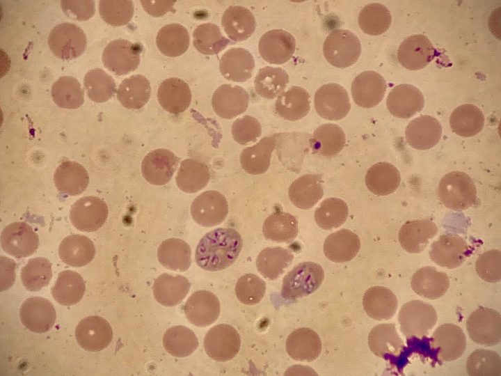 Мазок крови: внутриэритроцитарные включения простейших Babesia spp.