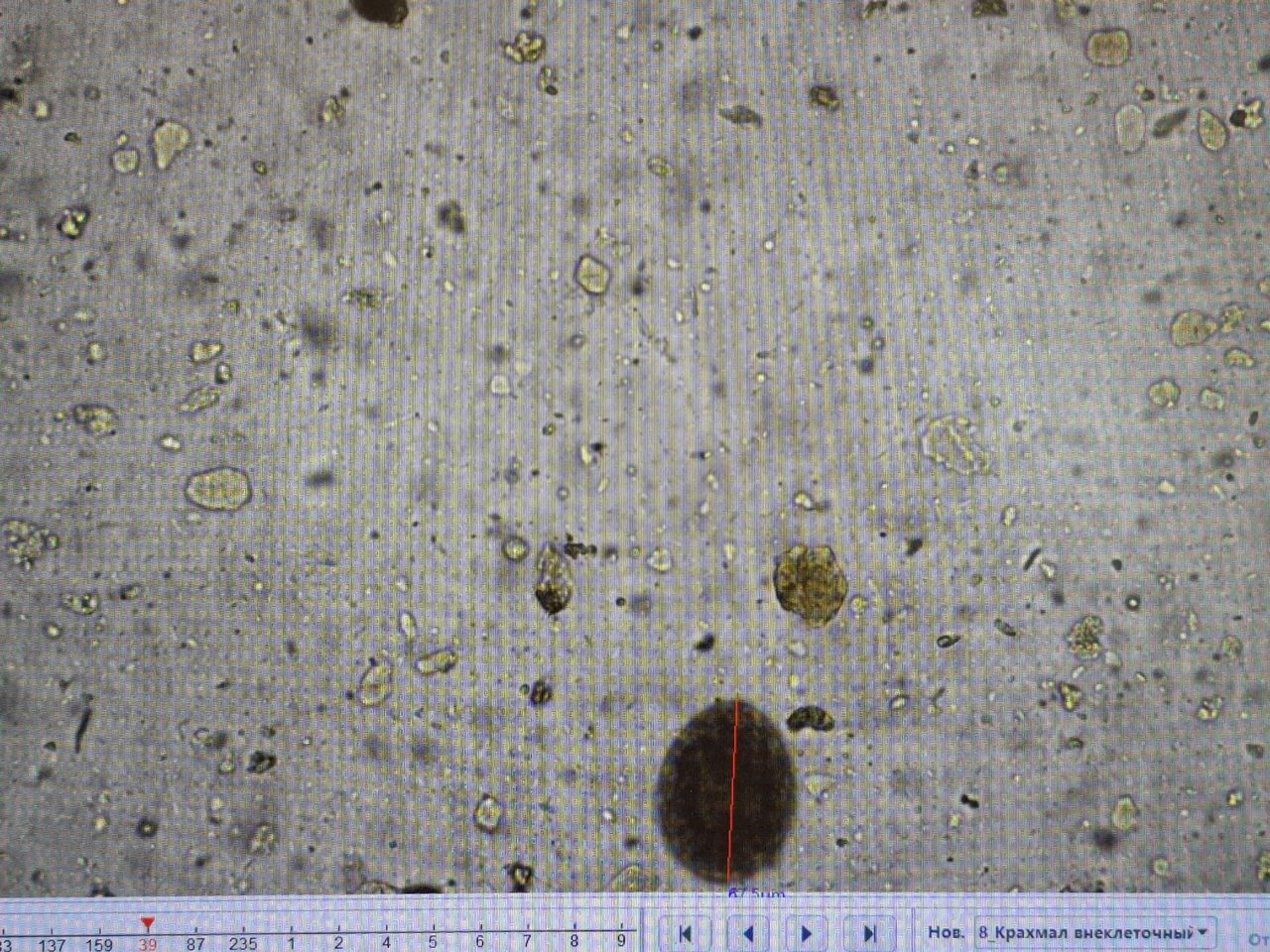 Fecal Microscopy: Differentiating Helminth Eggs from Artifacts