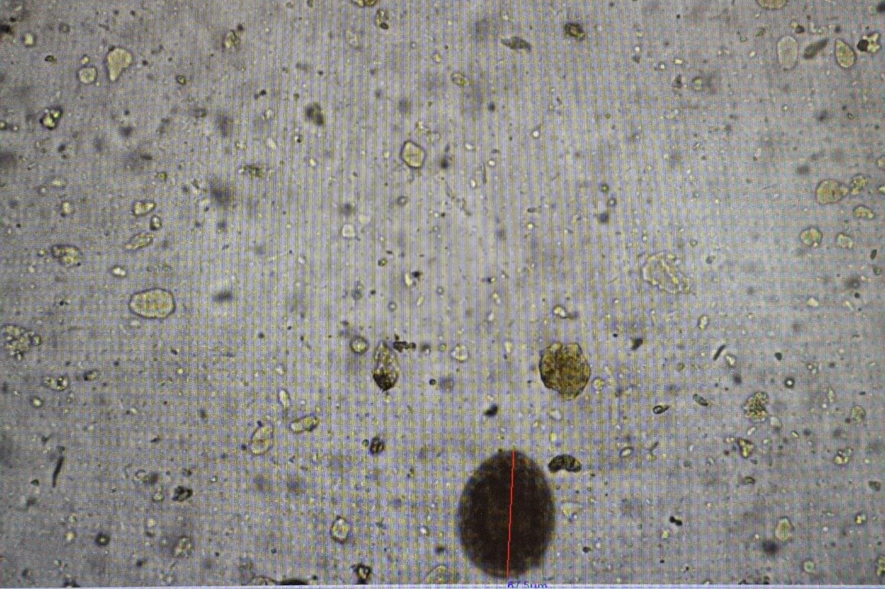 Fecal Microscopy: Differentiating Helminth Eggs from Artifacts