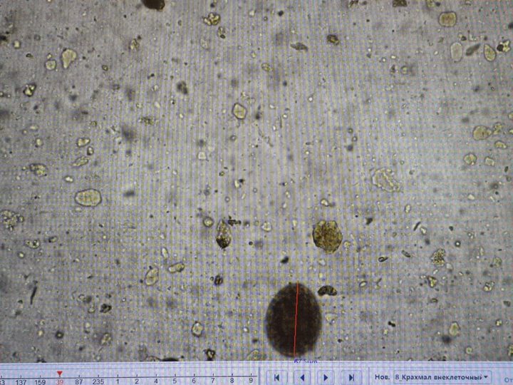 Native fecal smear, dark oval object approximately 67 µm in size at 20× magnification