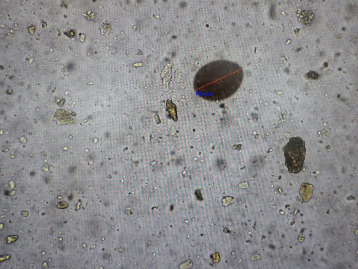 Native fecal smear, measuring a large ovoid inclusion on the monitor