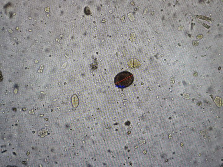 Native fecal smear, rounded-oval pigmented formation among detritus