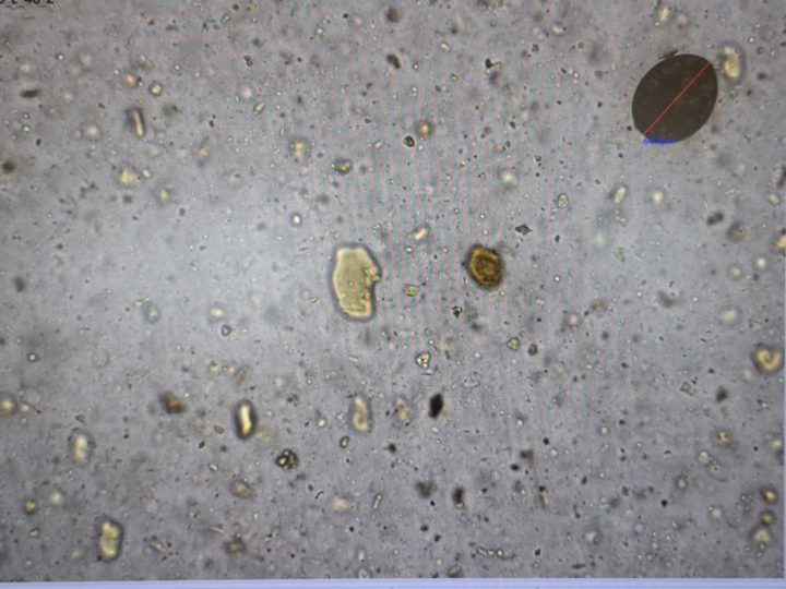 Native fecal smear, dark brown body in the upper corner of the field of view