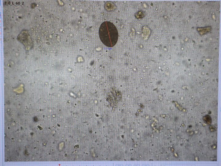 Native fecal smear, oval formation with a clear contour and length measurement
