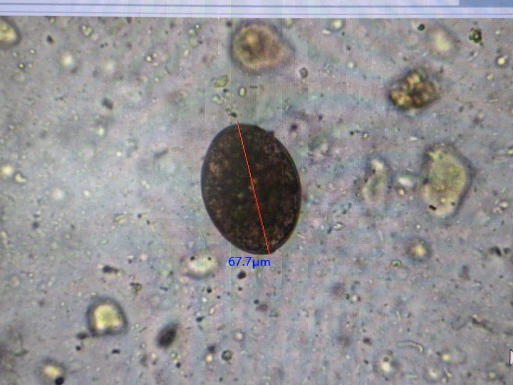 Native fecal smear, dark object 67.7 µm in size at higher magnification