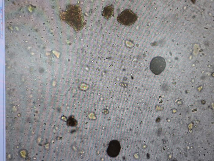 Native fecal smear, overview field of view with several dense particles