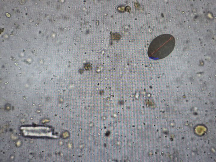 Native fecal smear, oval inclusion with a dense shell and measurement scale