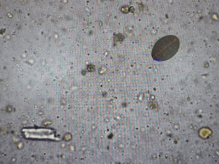 Native fecal smear, contrasting ovoid object against the background of intestinal detritus