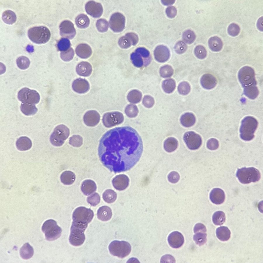 Mitoses in Feline Peripheral Blood with FeLV and FIV