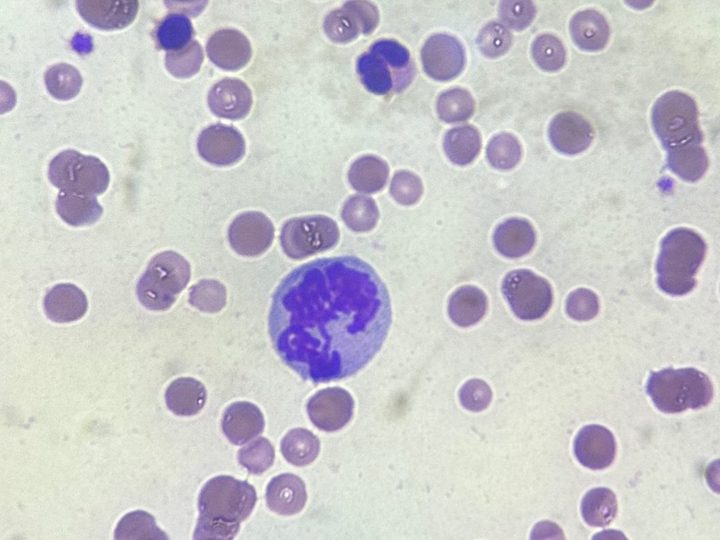 Cat blood smear with FeLV/FIV, mitotic figure in a leukocyte, 1000x magnification