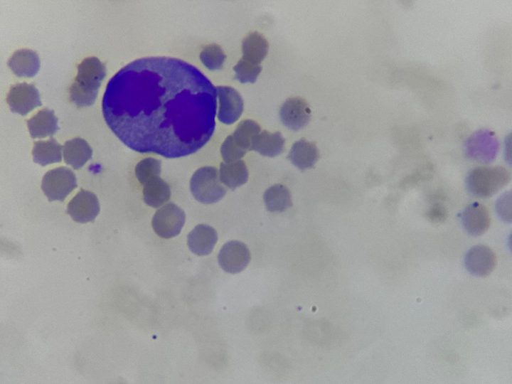 Cat blood smear, dividing cell in late mitosis, 1000x magnification