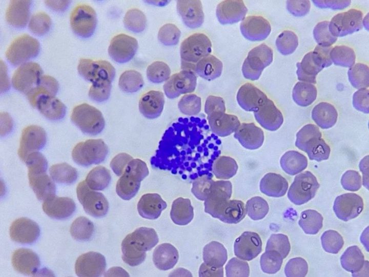 Ferret peripheral blood smear: basophil, Romanowsky-Giemsa stain, 1000x