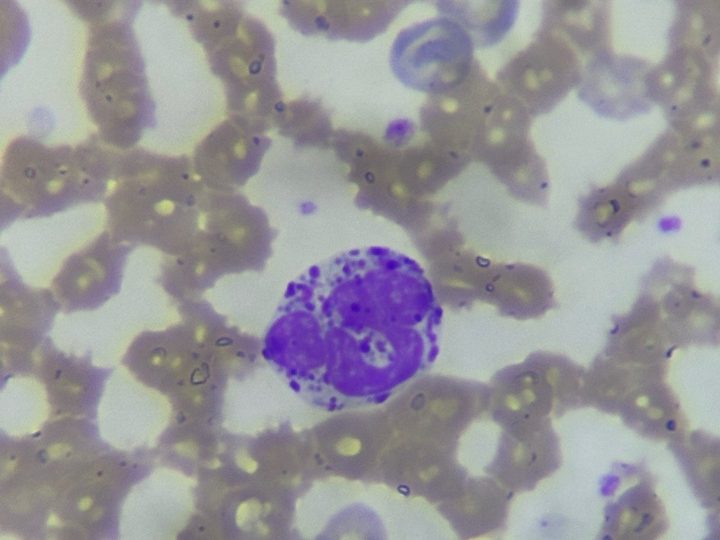 Dog peripheral blood smear: basophil with lobed nucleus and granules, 1000x