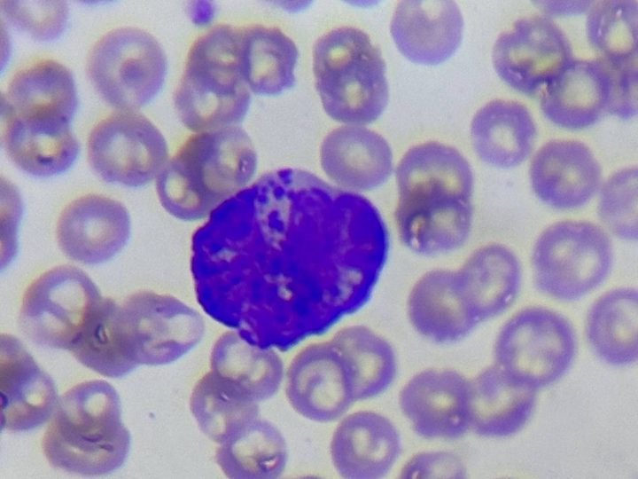 Cat peripheral blood smear: basophil with abundant granulation, 1000x