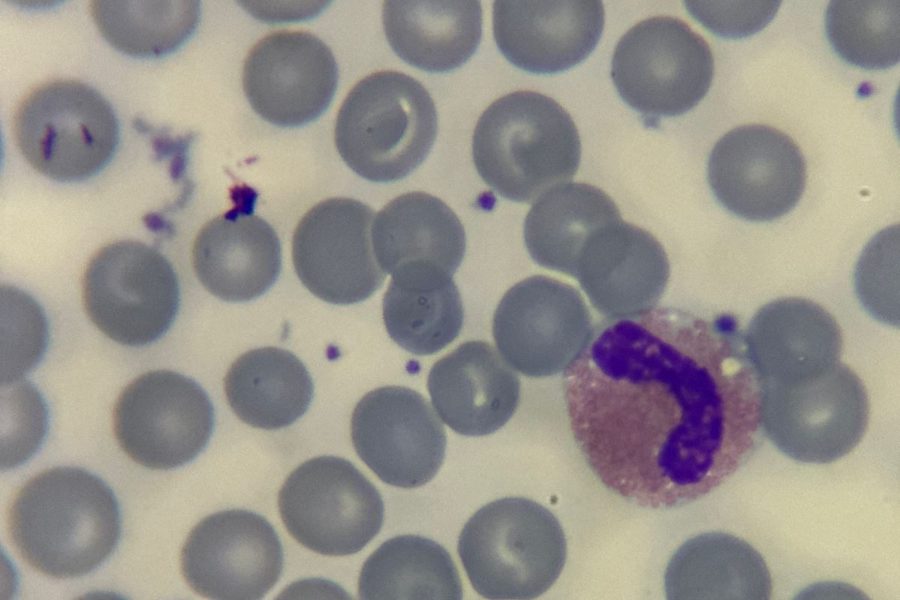 Eosinophil Morphology in Different Animal Species