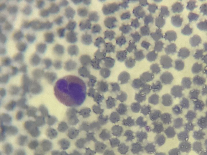 Blood smear, eosinophil against a background of small ruminant erythrocytes